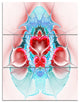 "Cold Extraterrestrial Fractal Heart Red" Metal Wall Art, 3 Panels, 28"x36"