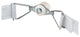 Dare 2810-N Electric Fencing Corner Tensioner for 1-1/2" Polytape