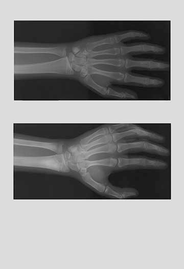 Left Hand- Gallery Wrapped Canvas Art 28" x 42"
